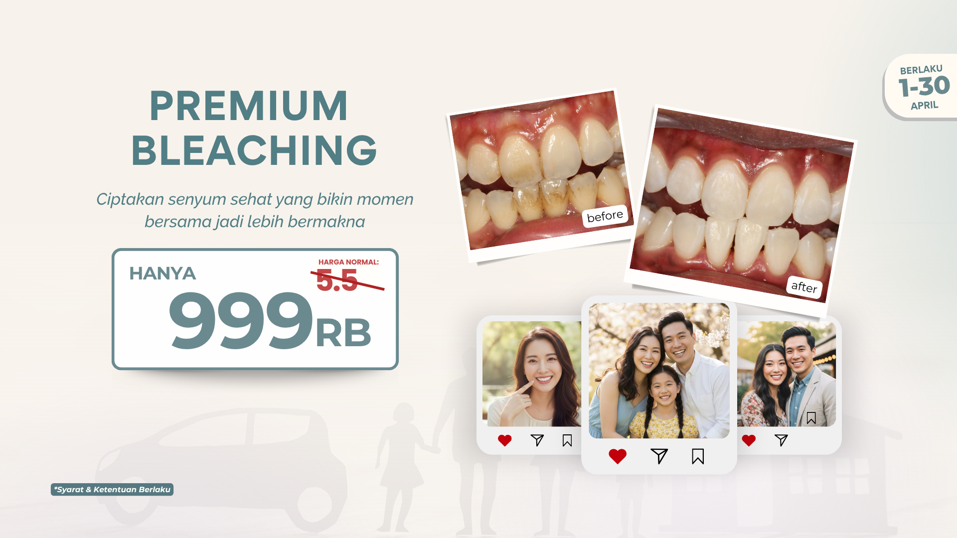 Promo Behel Metal Premium